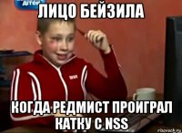 лицо бейзила когда редмист проиграл катку с nss