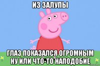 из залупы глаз показался огромным ну или что-то наподобие