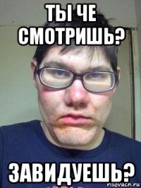 ты че смотришь? завидуешь?