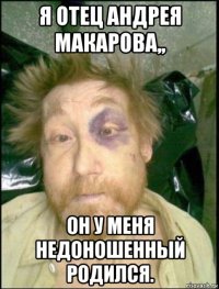 я отец андрея макарова,, он у меня недоношенный родился.