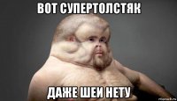 вот супертолстяк даже шеи нету