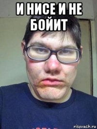 и нисе и не бойит 