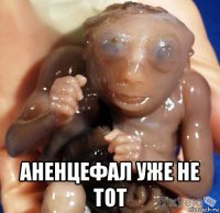  аненцефал уже не тот