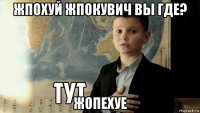 жпохуй жпокувич вы где? жопехуе