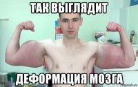 так выглядит деформация мозга