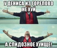 у дениса из горелово не хуй а спидозное хуище!