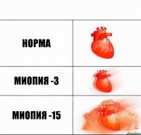Норма Миопия -3 Миопия -15