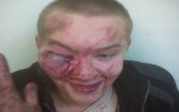 Избитый