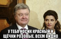  у тебя носик красный и щёчки розовые. всем видно
