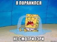 я поранился не смотри гэри