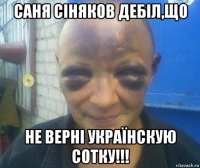 саня сіняков дебіл,що не верні українскую сотку!!!