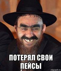  потерял свои пейсы