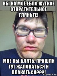 вы на моё ебло жуткое отвратительное гляньте! мне вы,блять, пришли тут жаловаться и плакаться???!