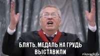  блять, медаль на грудь выставили