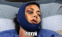  похуй