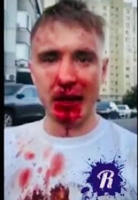 Создать мем Коваленко после драки с Чеченцами
