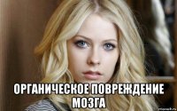  органическое повреждение мозга