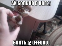 ай больно в ноге.¡ блять.¡¿ (fffuuu)