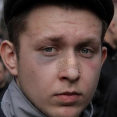 Толян Пластир
