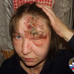 Когла