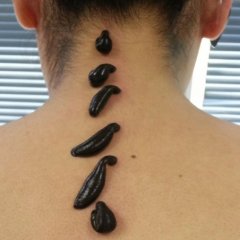 Пиявки