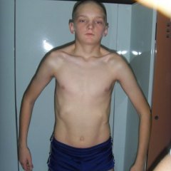 Дрыщ