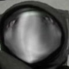 Scp 049