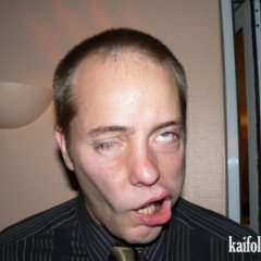 Дибил