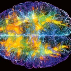 Glass Brain Project