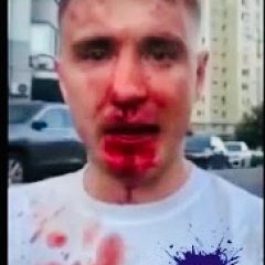 Коваленко после драки с Чеченцами