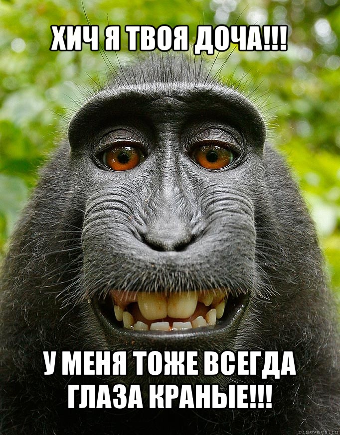 хич я твоя доча!!! у меня тоже всегда глаза краные!!!