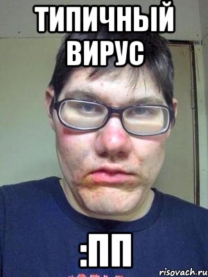 типичный вирус :пп