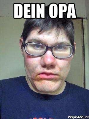 dein opa 