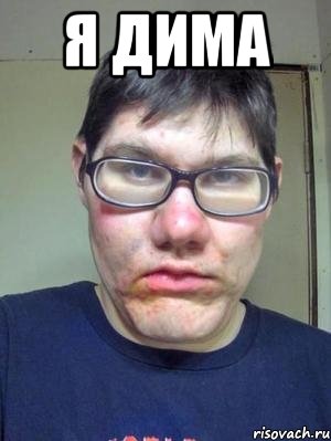 я дима 