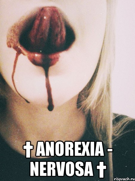  † anorexia - nervosa †, Мем  Anorexia - nervosa 