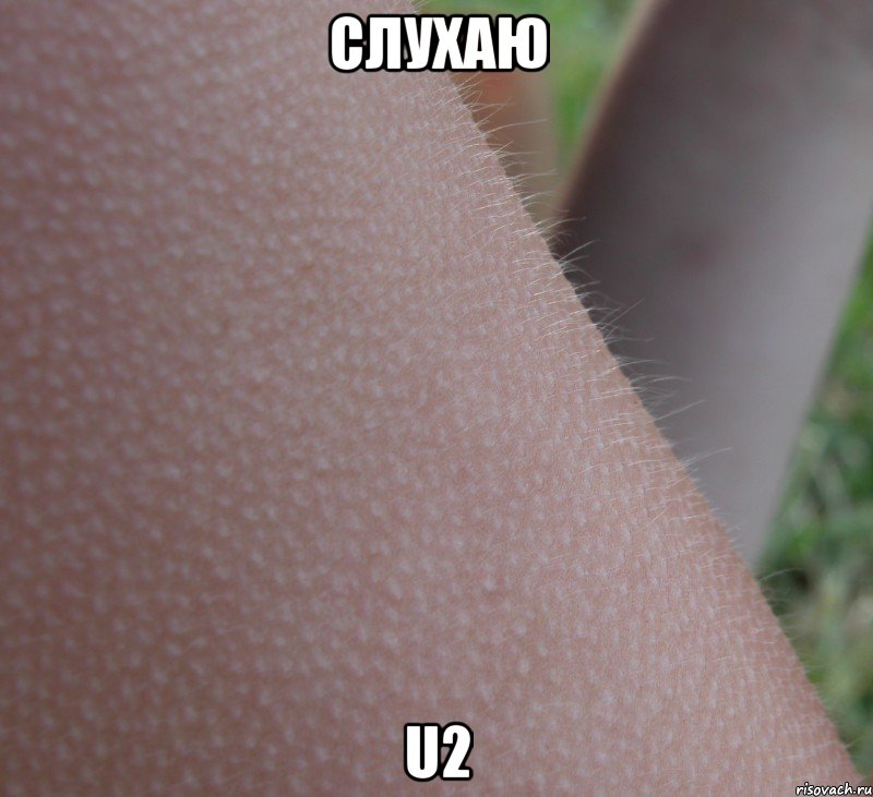 слухаю u2, Мем гусиная кожа