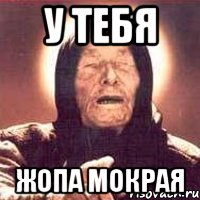 у тебя жопа мокрая, Мем Ванга (цвет)