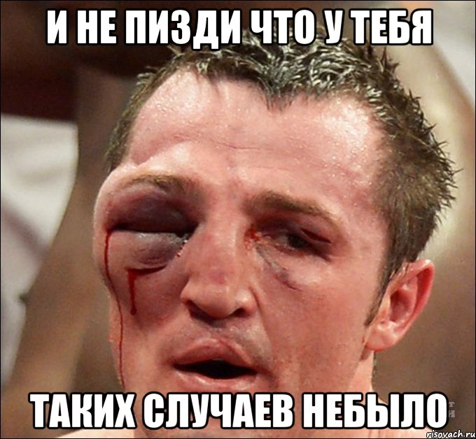 и не пизди что у тебя таких случаев небыло