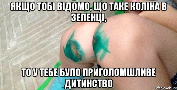 якщо тобі відомо, що таке коліна в зеленці, то у тебе було приголомшливе дитинство, Мем уекц