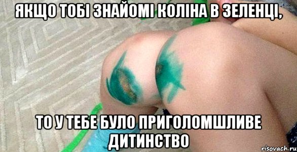 якщо тобі знайомі коліна в зеленці, то у тебе було приголомшливе дитинство, Мем уекц