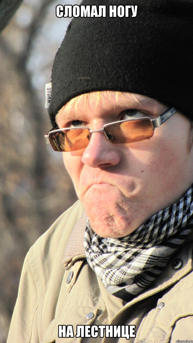 сломал ногу на лестнице