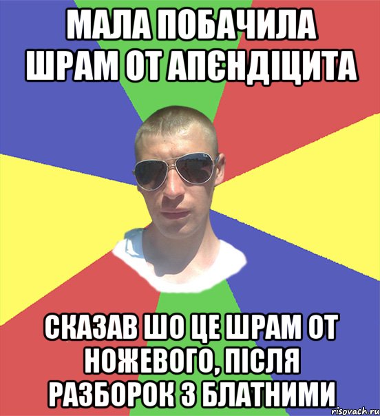 мала побачила шрам от апєндіцита сказав шо це шрам от ножевого, після разборок з блатними