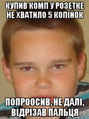 купив комп у розетке не хватило 5 копійок попроосив, не далі, Відрізав пальця