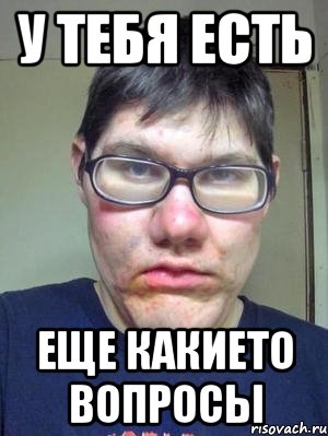 У тебя есть еще какието вопросы