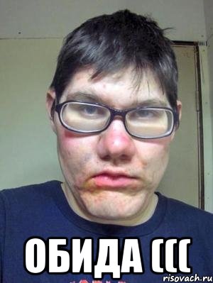  ОБИДА (((, Мем красавчик