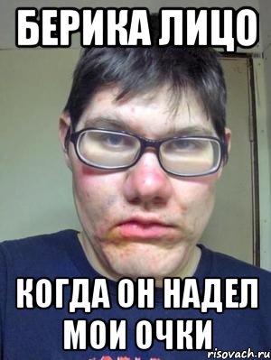 БЕРИКА ЛИЦО КОГДА ОН НАДЕЛ МОИ ОЧКИ, Мем красавчик