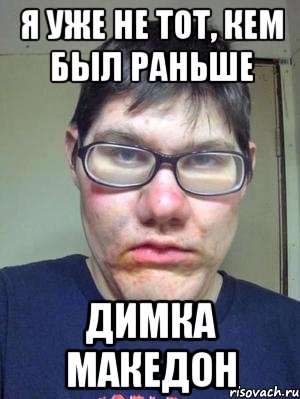 Я уже не тот, кем был раньше Димка македон, Мем красавчик