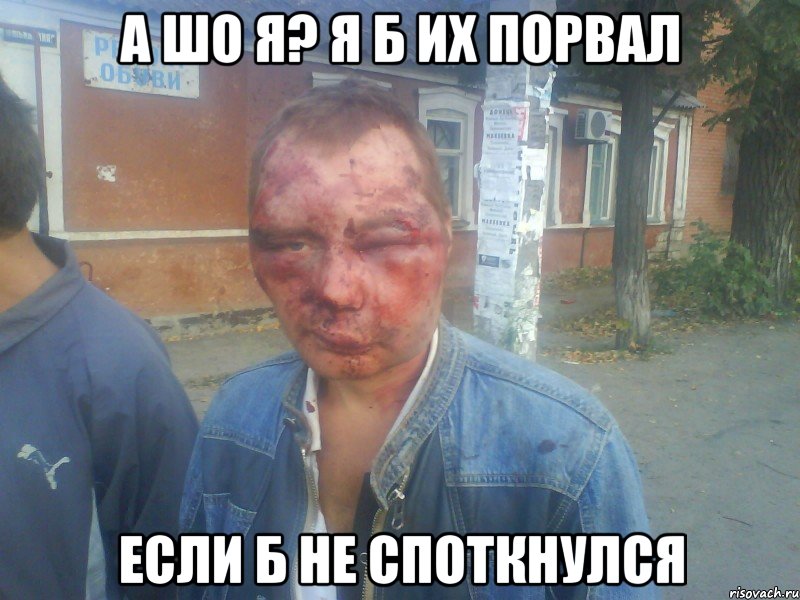 а шо я? я б их порвал если б не споткнулся
