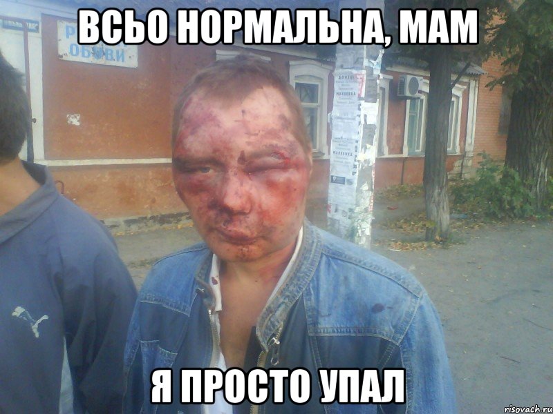 всьо нормальна, мам я просто упал