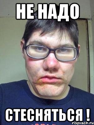 не надо стесняться !, Мем красавчик